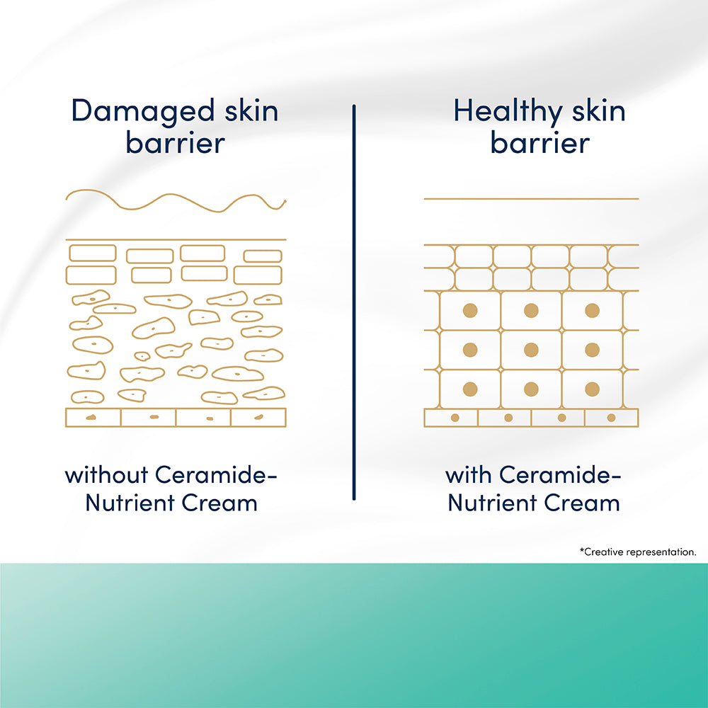 Dove Advanced Sensitive Care Bar with Ceramide nutrient cream, 3x125g