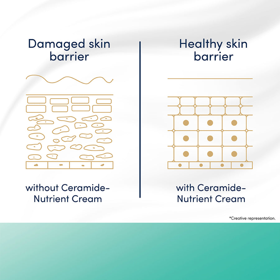 Dove Advanced Sensitive Care Bar with Ceramide nutrient cream, 3x125g